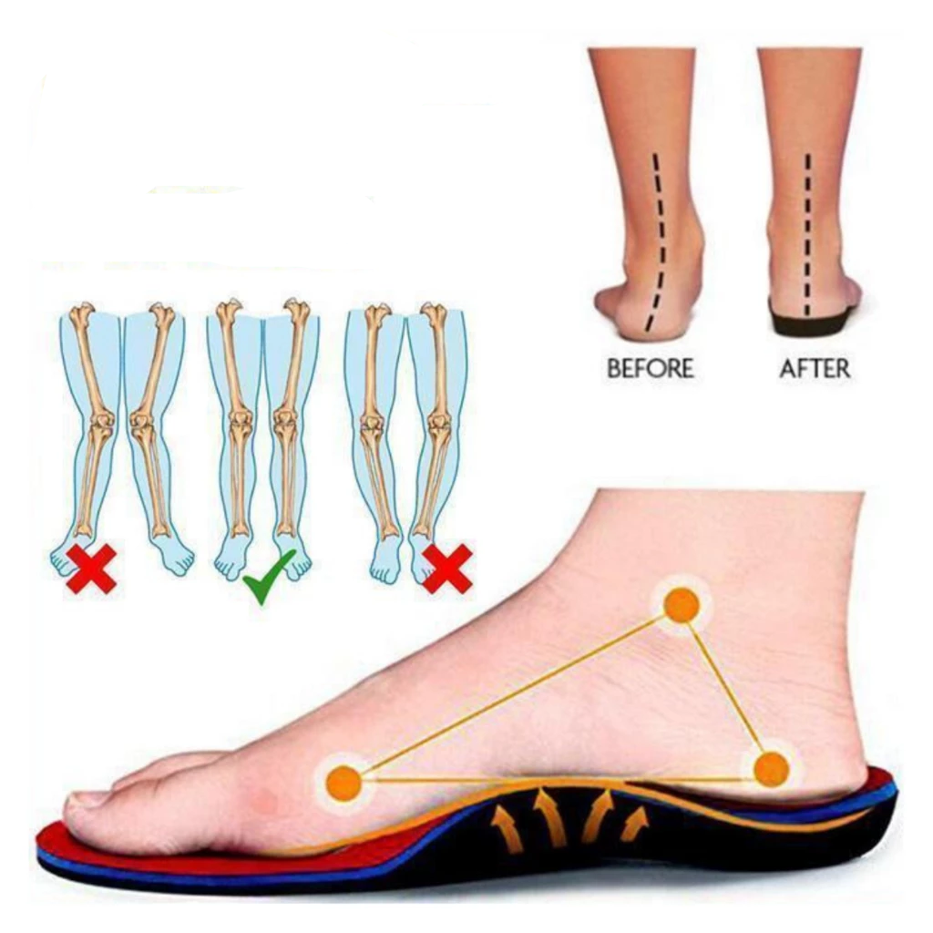 Ortopediniai-universalūs-vidpadžiai