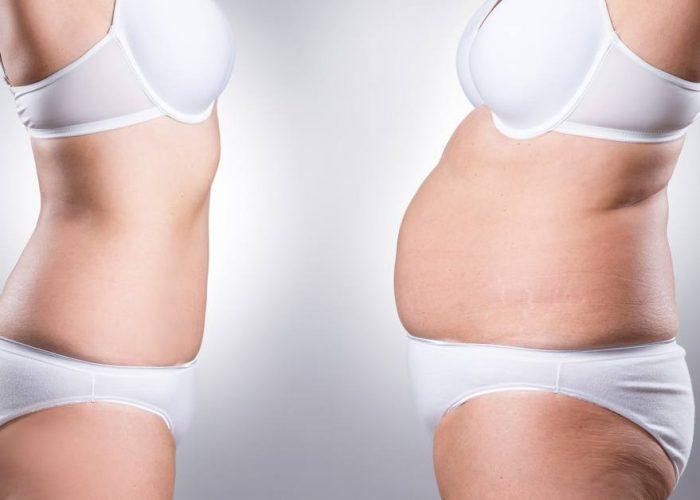 Liekninamieji-magnetiniai-detoksikuojantys-pleistrai