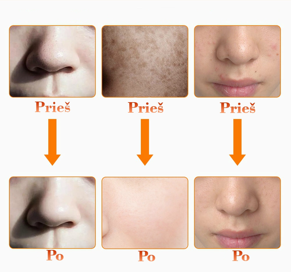 LED-šviesos-terapijos-kaukė-veidui