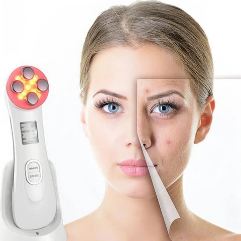 Fotonų-EMS-radijo-dažnio-bangų-ir-elektroporacijos-prietaisas-veidui