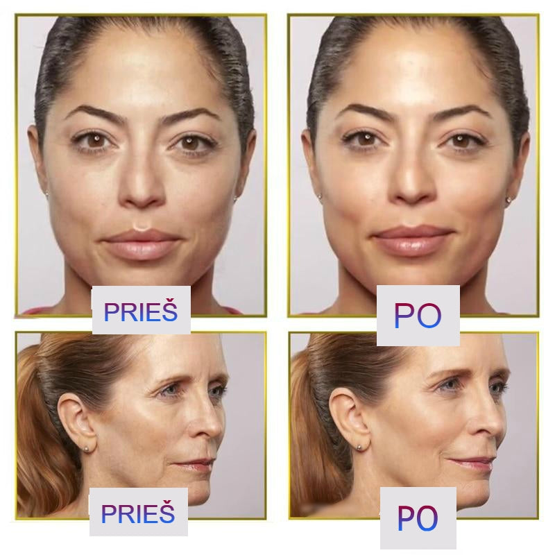 Elektrinis-skustuvas-veidui