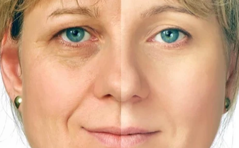 Elektrinis-akių-masažuoklis